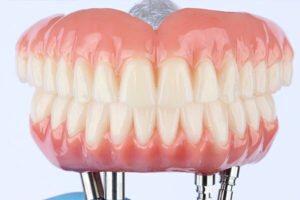 Leia mais sobre o artigo Você sabe o que é Prótese Protocolo Sobre Implantes?