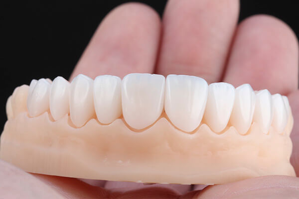 No momento, você está visualizando Qual a melhor clínica para colocação de Facetas de Porcelana em Chapecó?