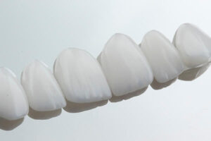 Leia mais sobre o artigo Mais sobre Lentes de Contato Dental