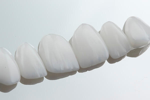 Leia mais sobre o artigo Mais sobre Lentes de Contato Dental