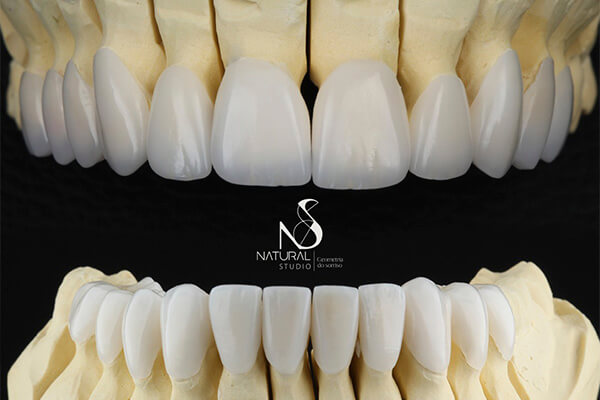 No momento, você está visualizando Saiba dos benefícios da Reabilitação Oral