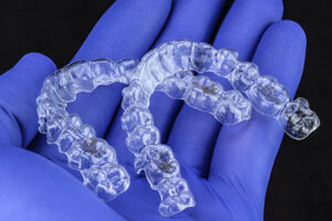 Leia mais sobre o artigo Dúvidas sobre Invisalign®?