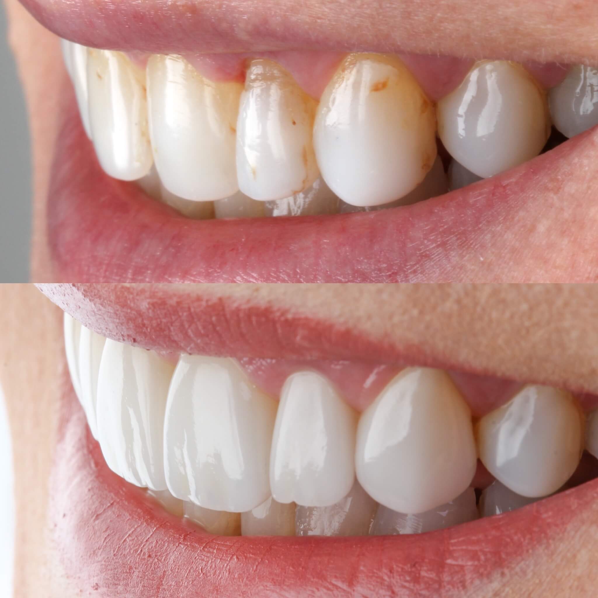 27CC8791-A2A4-4472-8BC3-5C2D690E220A